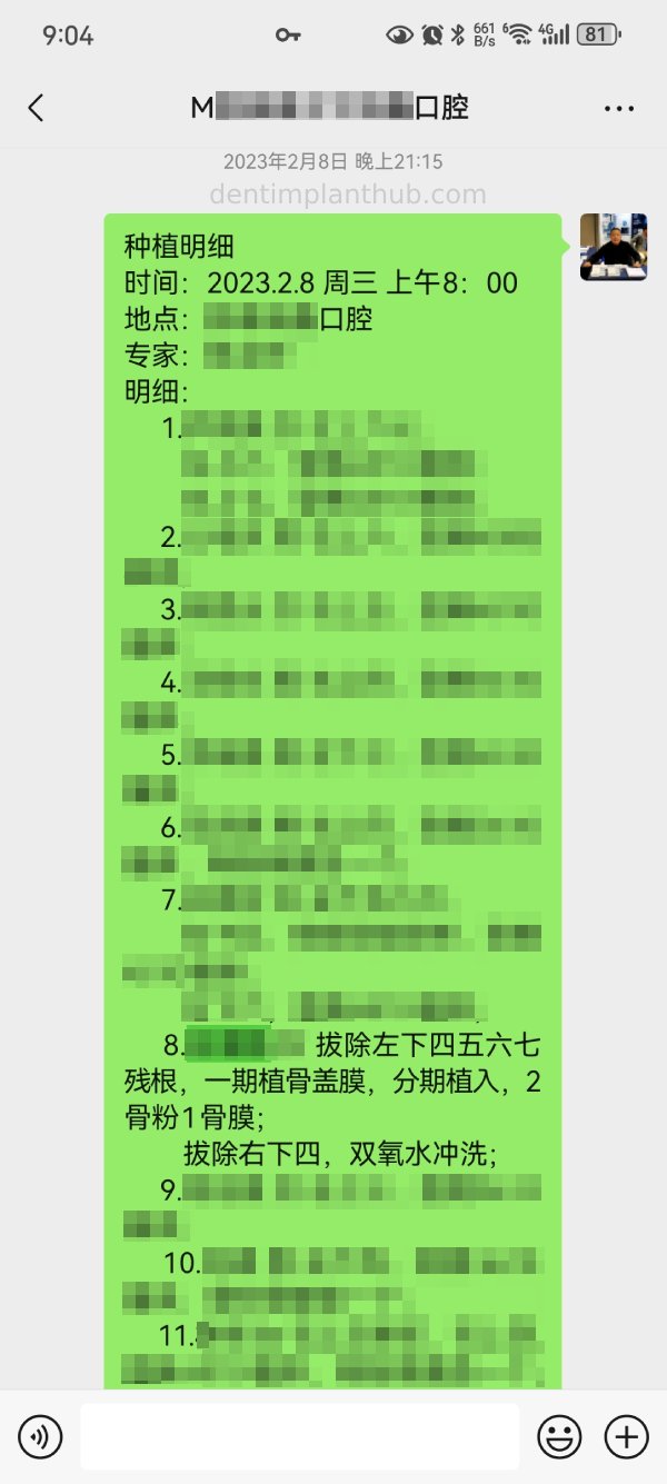 Case 3: Full mouth all-on-6 in a patient with severe periodontal disease
