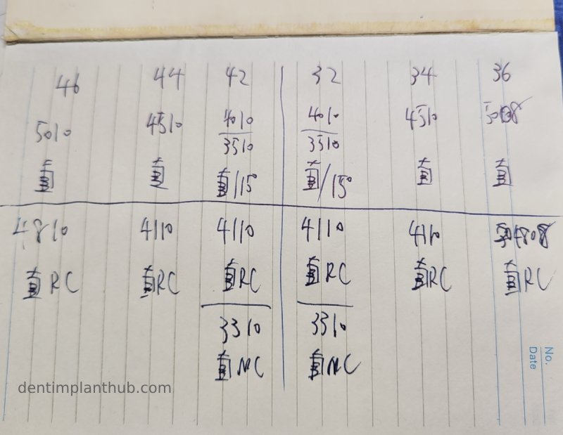 Case 3: Full mouth all-on-6 in a patient with severe periodontal disease