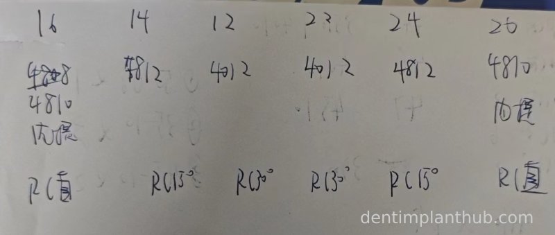 Case 3: Full mouth all-on-6 in a patient with severe periodontal disease