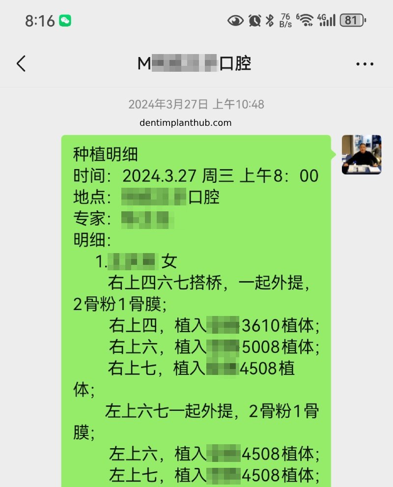 Case 4: Bilateral maxillary sinus lateral wall openings